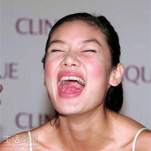 蛀牙严重的明星